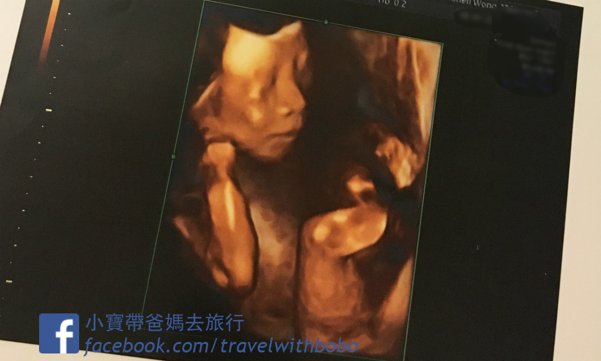 懷孕經歷】孕期3項最重要檢查|