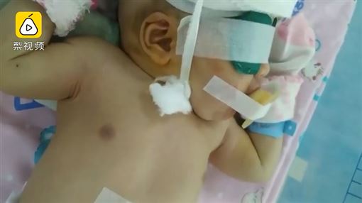 驚險 孕婦在家散步突分娩胎兒滑出頭部墜地顱內血腫險死 生活熱話