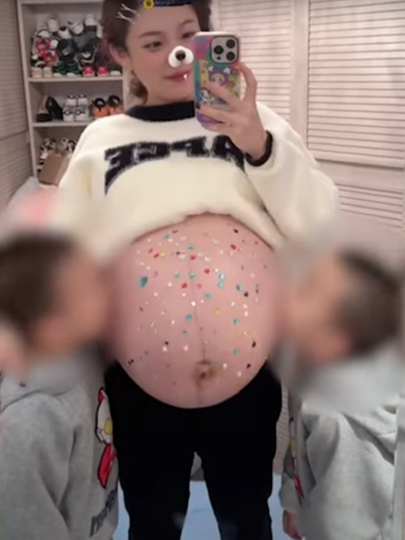 醫學人生──雙胞胎– 醫學人生, image size:810x1080